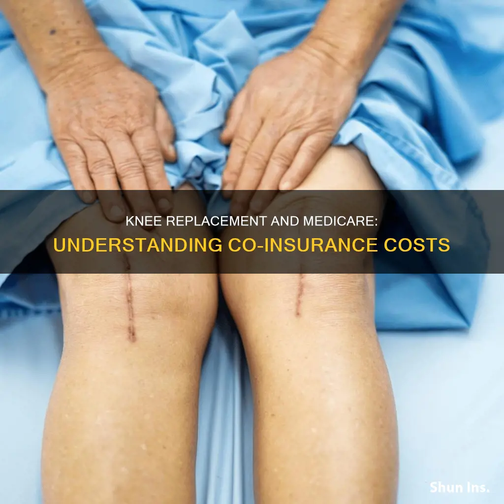 is there co insurance for medicare knee replacement