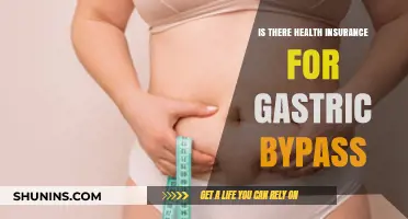 Exploring Health Insurance Coverage for Gastric Bypass Surgery