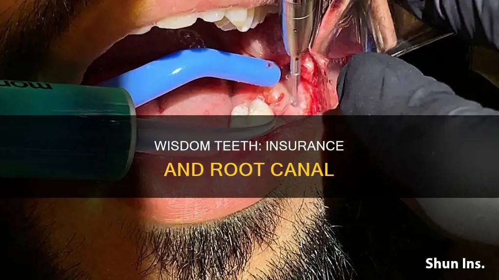 is wisdom teeth extraction considered root canal to insurance