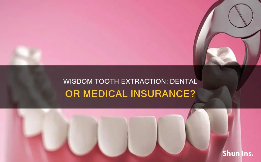 is wisdom tooth extraction under dental or medical insurance