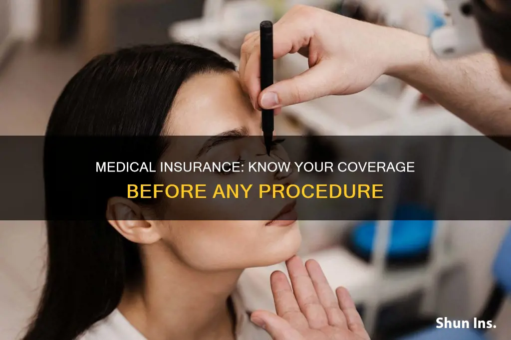 must medical insurance provide their coverage before procedure