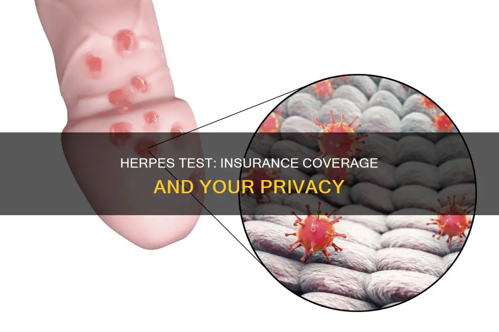 should I go through my insurance for herpes test