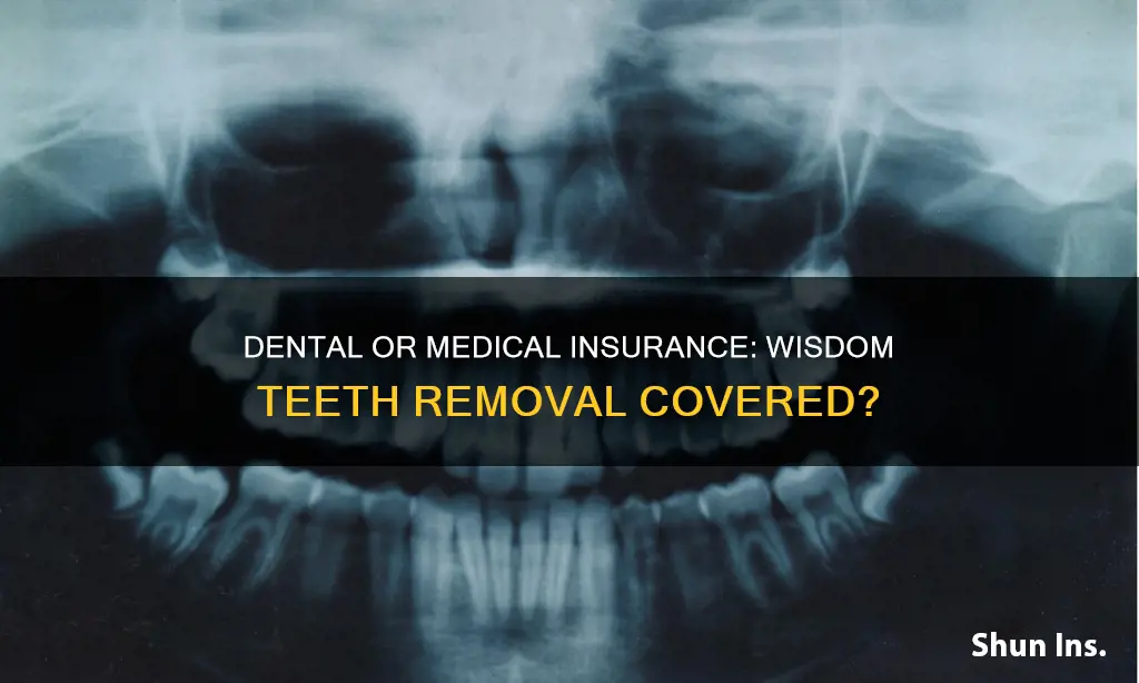 should you use medical or dental insurance for wisdom teeth