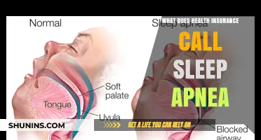 Decoding Sleep Apnea: What Health Insurance Companies Term It