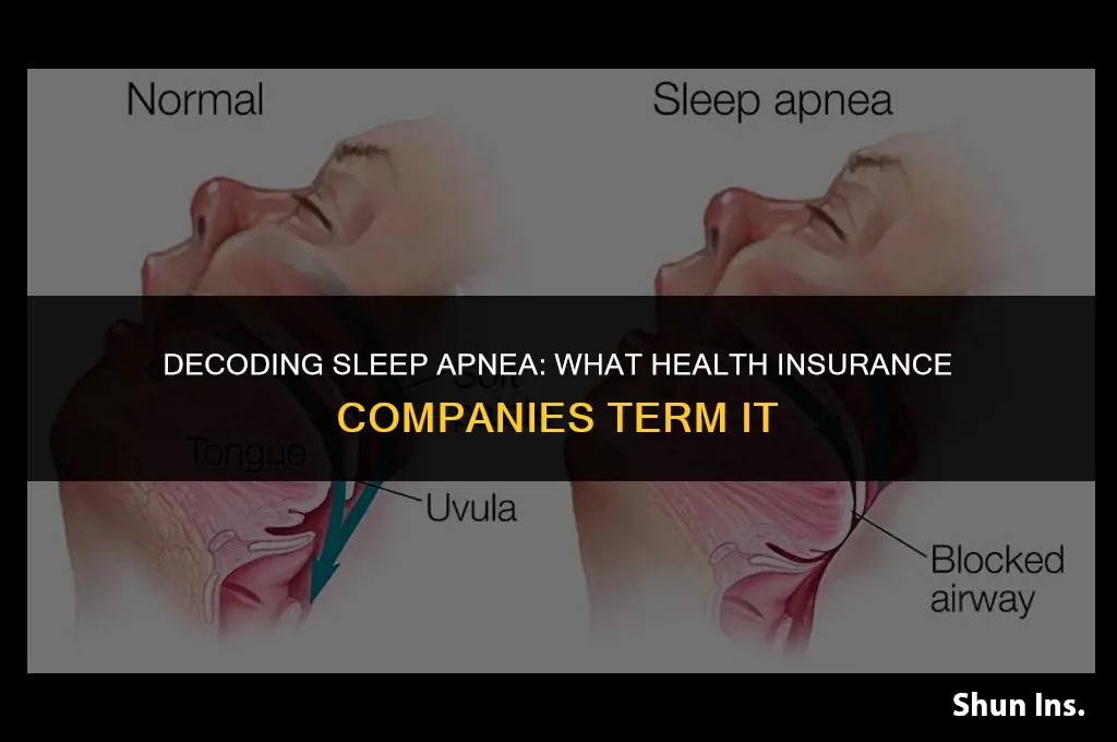 what does health insurance call sleep apnea