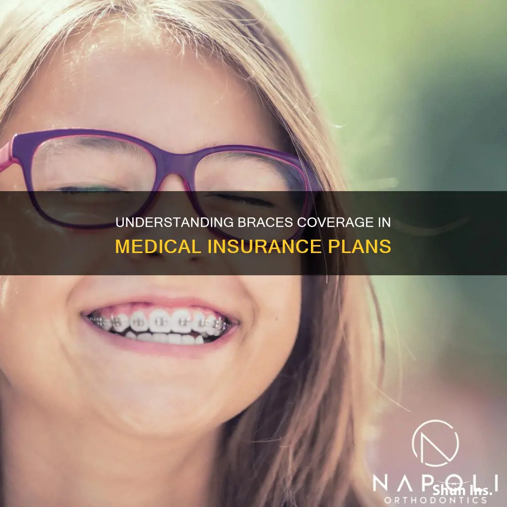 what does medical insurance cover braces
