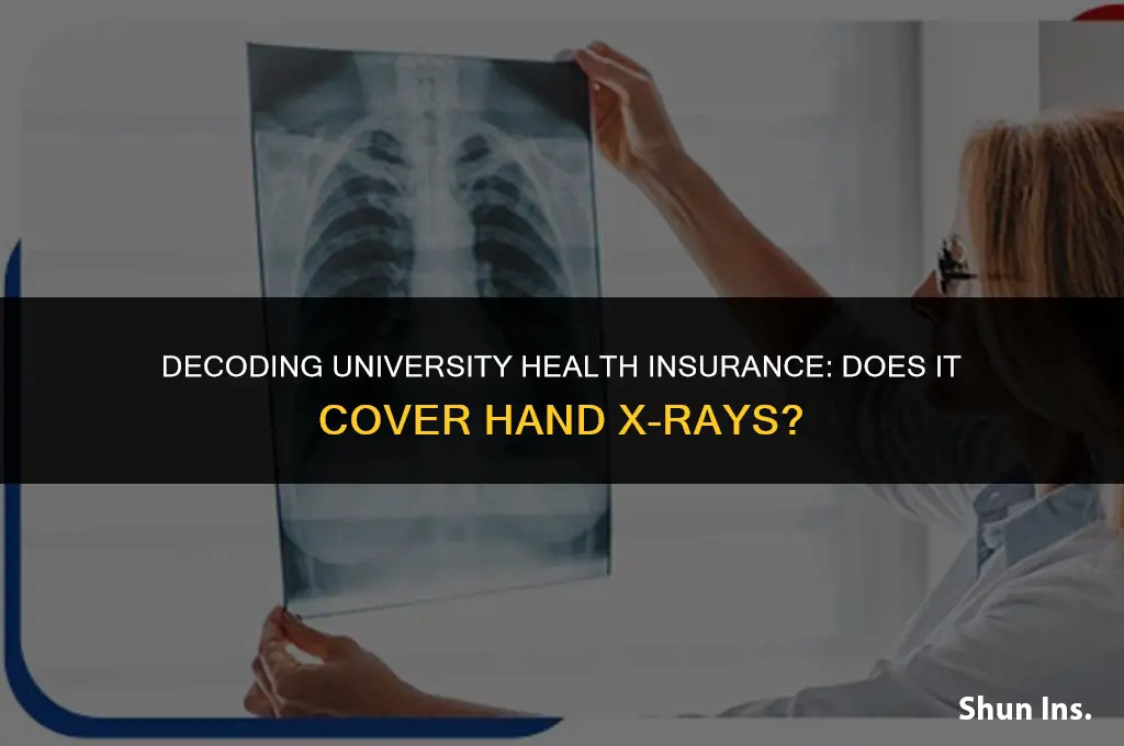 what does university health insurance cover hand xray