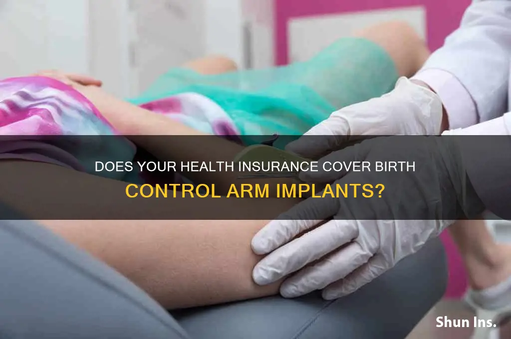 what health insurance cover birth control arm implants