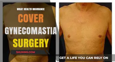 Does Your Health Insurance Cover Gynecomastia Surgery? Find Out Here