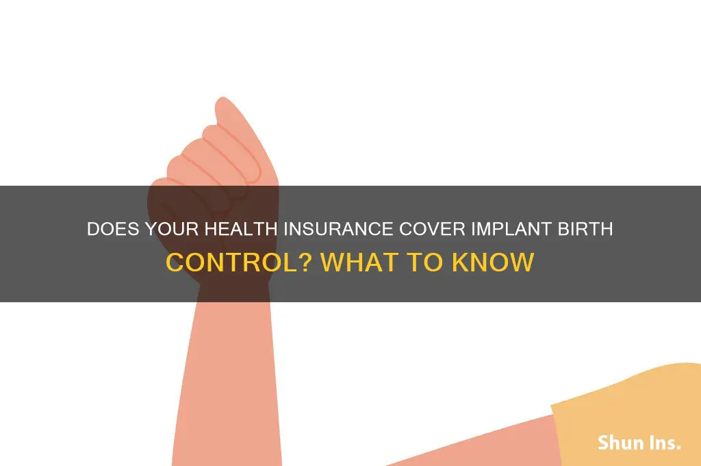 what health insurance cover implant birth
