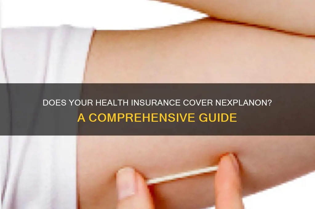 what health insurance cover nexplanon