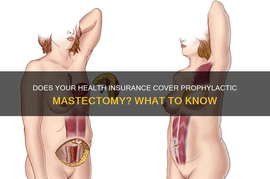 what health insurance cover prophylactic mastectomy