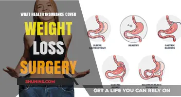 Does Your Health Insurance Cover Weight Loss Surgery? Find Out Here