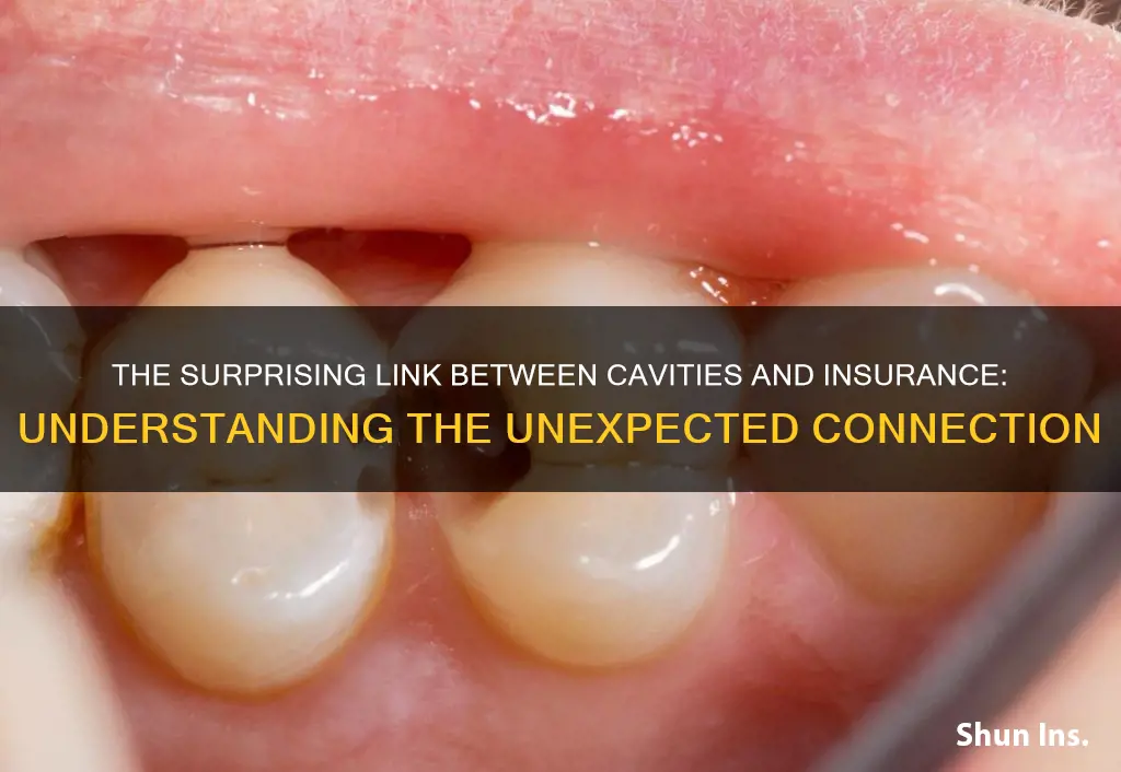 what is a cavity considered in insurance terms