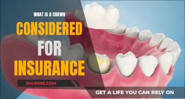 Dental Crowns: Insurance Coverage?