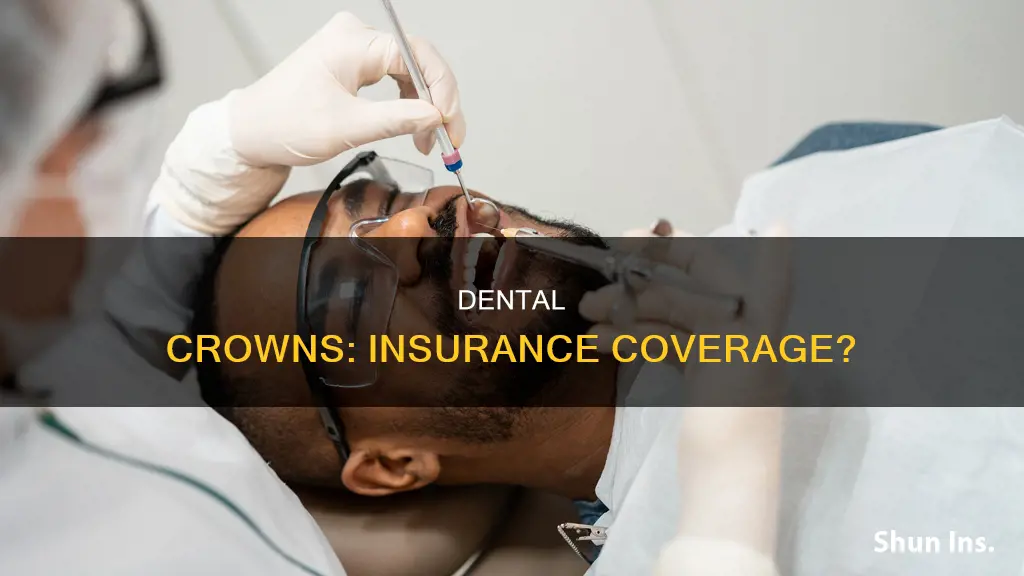 what is a crown considered for insurance