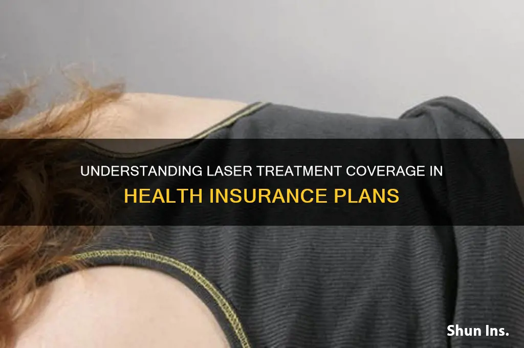 what is a laser in health insurance