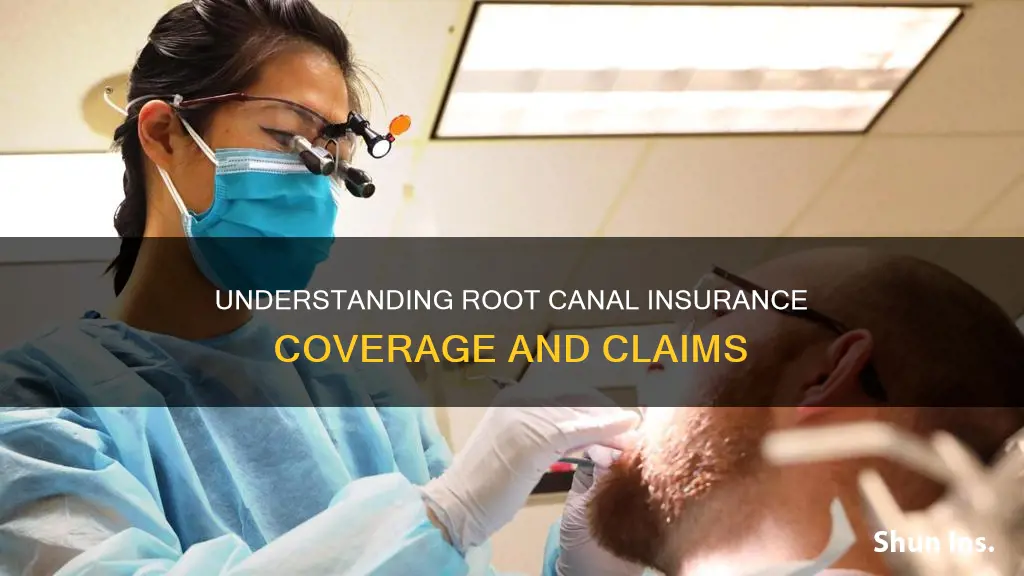 what is a root canal called for insurance
