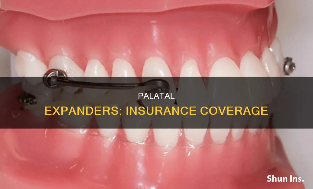 what is an palatal expander considered for insurance