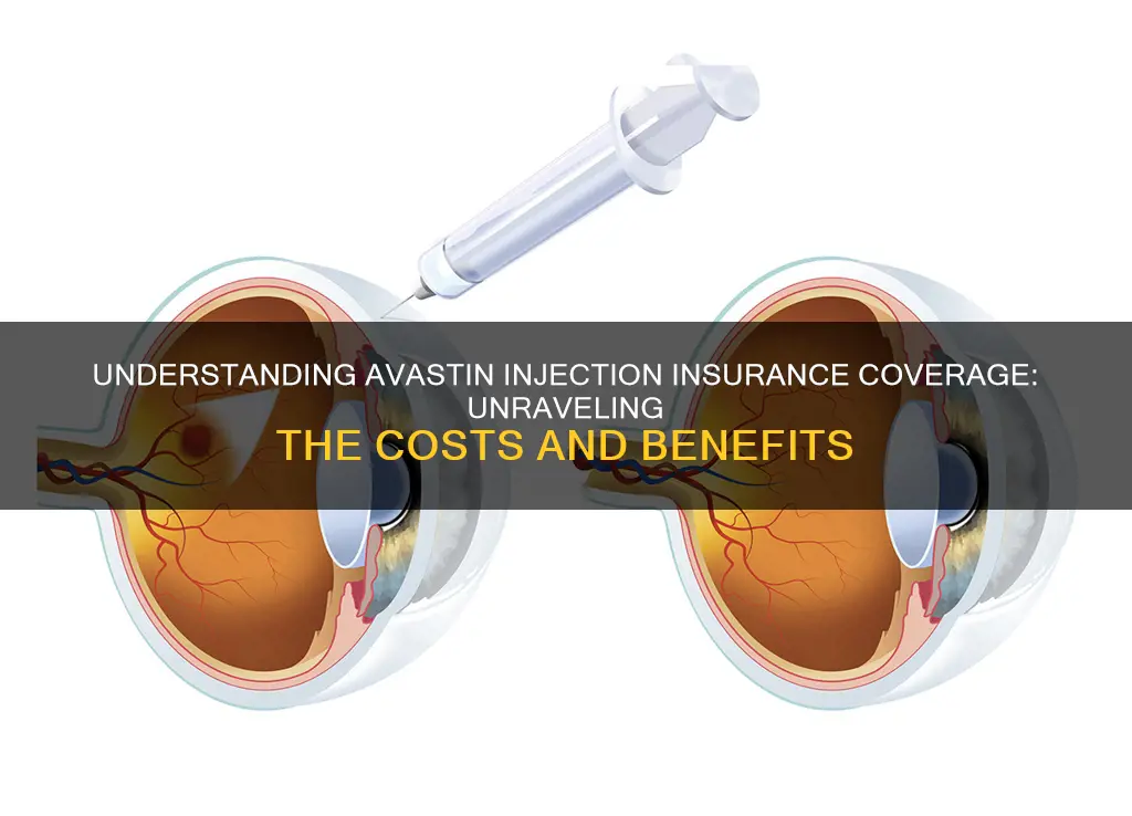 what is insurance billed for interocular injection of avastin