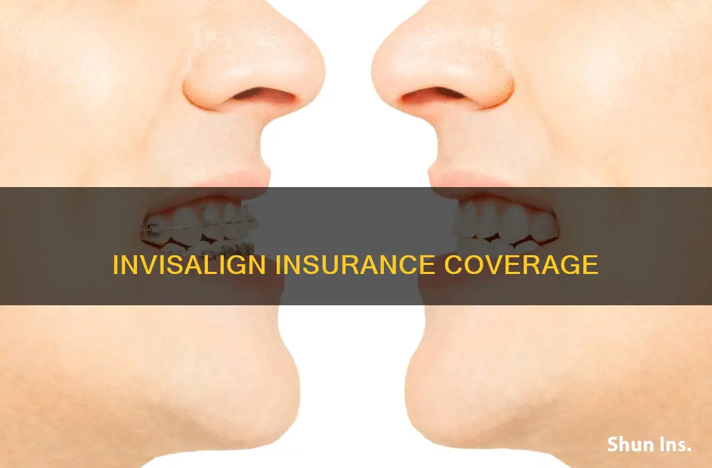 what is invisalign considered for insurance