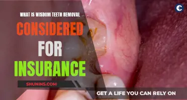 Wisdom Teeth Removal: Insurance Coverage?