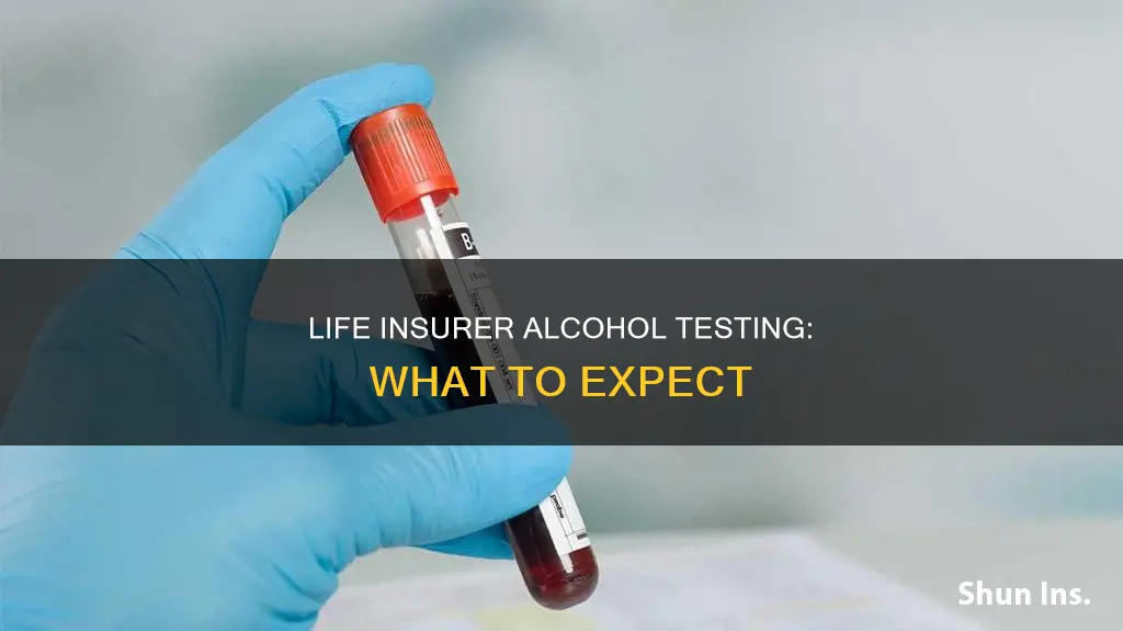 what kind of alchohol tests does life insurer do
