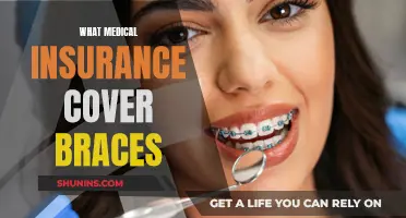 How Insurance Coverage Affects Your Braces Treatment