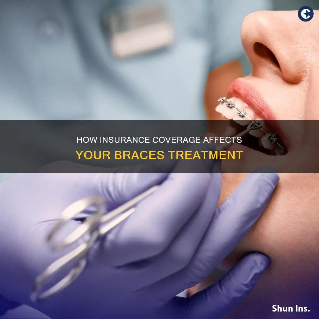 what medical insurance cover braces
