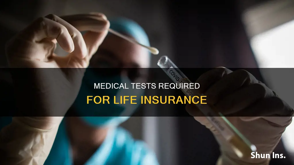 what medical tests are done for life insurance