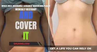 Abdominalplasty: When Does Insurance Deem It Medically Necessary?