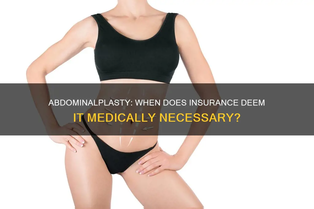when does insurance consider abdominalplasty medically necessary and cover it