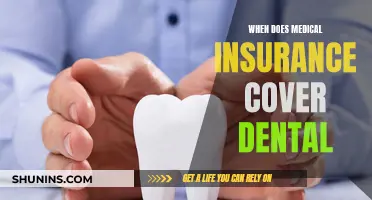 Dental Coverage: When Does Medical Insurance Apply?
