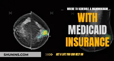 Scheduling Mammograms with Medicaid: Where to Go?