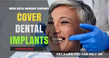Top Dental Insurance Providers Offering Coverage for Dental Implants