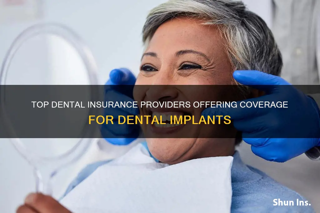 which dental insurance companies cover dental implants