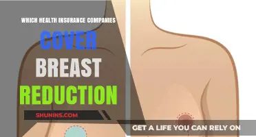Top Health Insurance Providers Covering Breast Reduction Surgery: A Guide