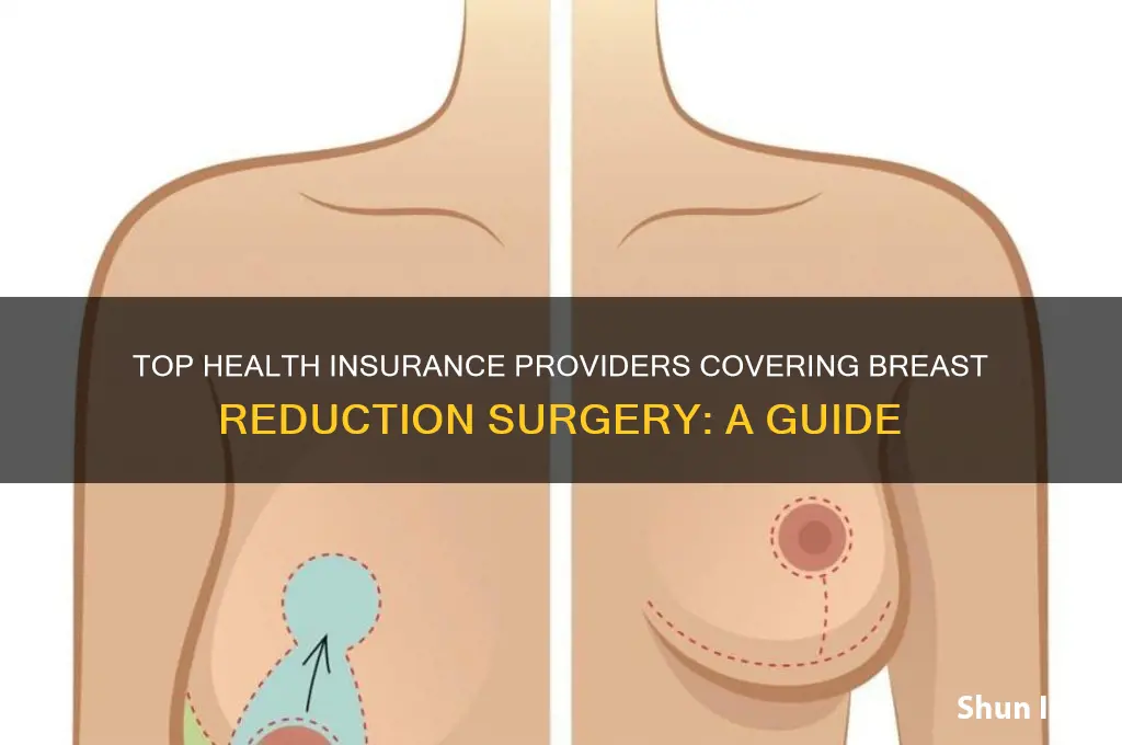 which health insurance companies cover breast reduction