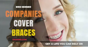 Top Insurance Providers Offering Braces Coverage: A Comprehensive Guide