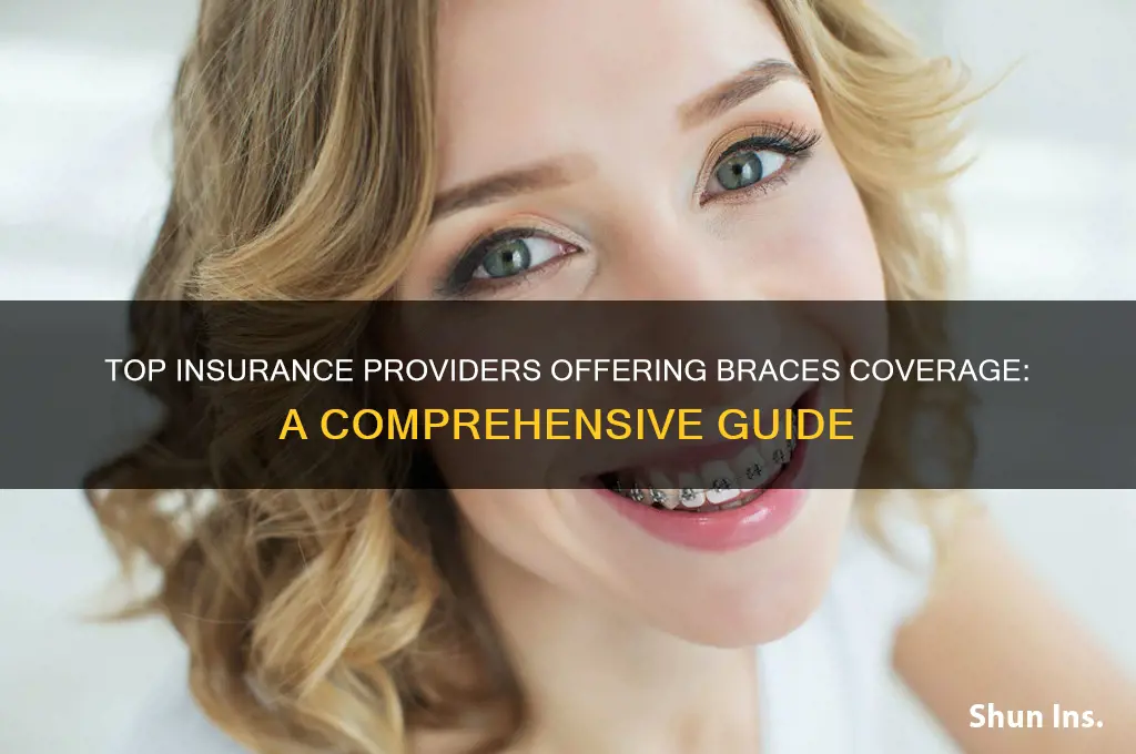 which insurance companies cover braces