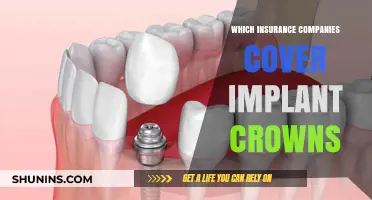Top Insurance Providers Covering Implant Crowns: A Comprehensive Guide
