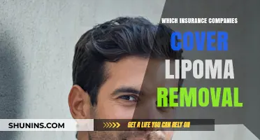 Lipoma Removal Coverage: Which Insurance Companies Offer Financial Support?