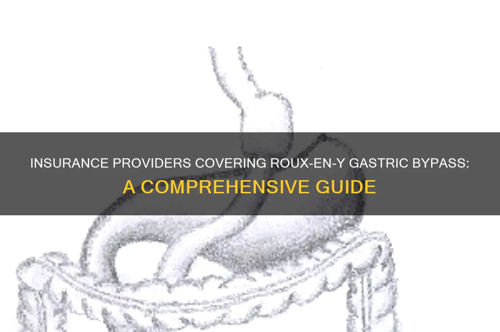 which insurance companies cover roux-en-y gastric bypass