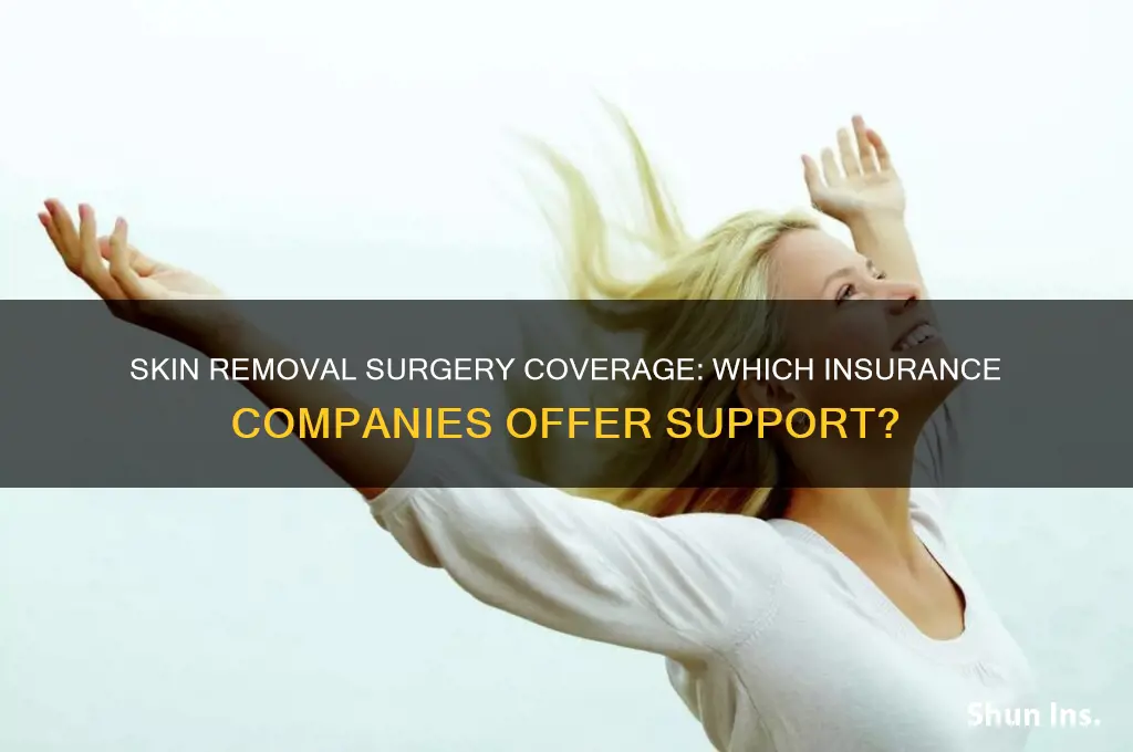 which insurance companies cover skin removal