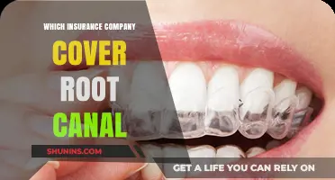 Root Canal Coverage: Which Insurance Companies Offer the Best Plans?