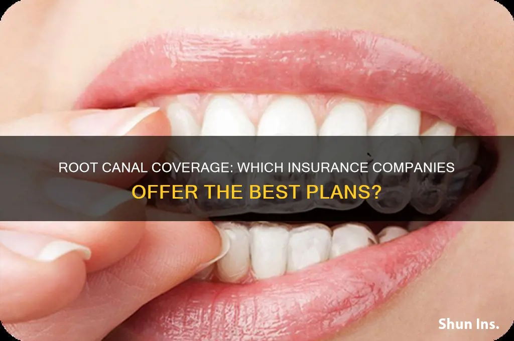 which insurance company cover root canal