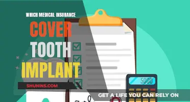Implant Coverage: Choosing the Right Medical Insurance