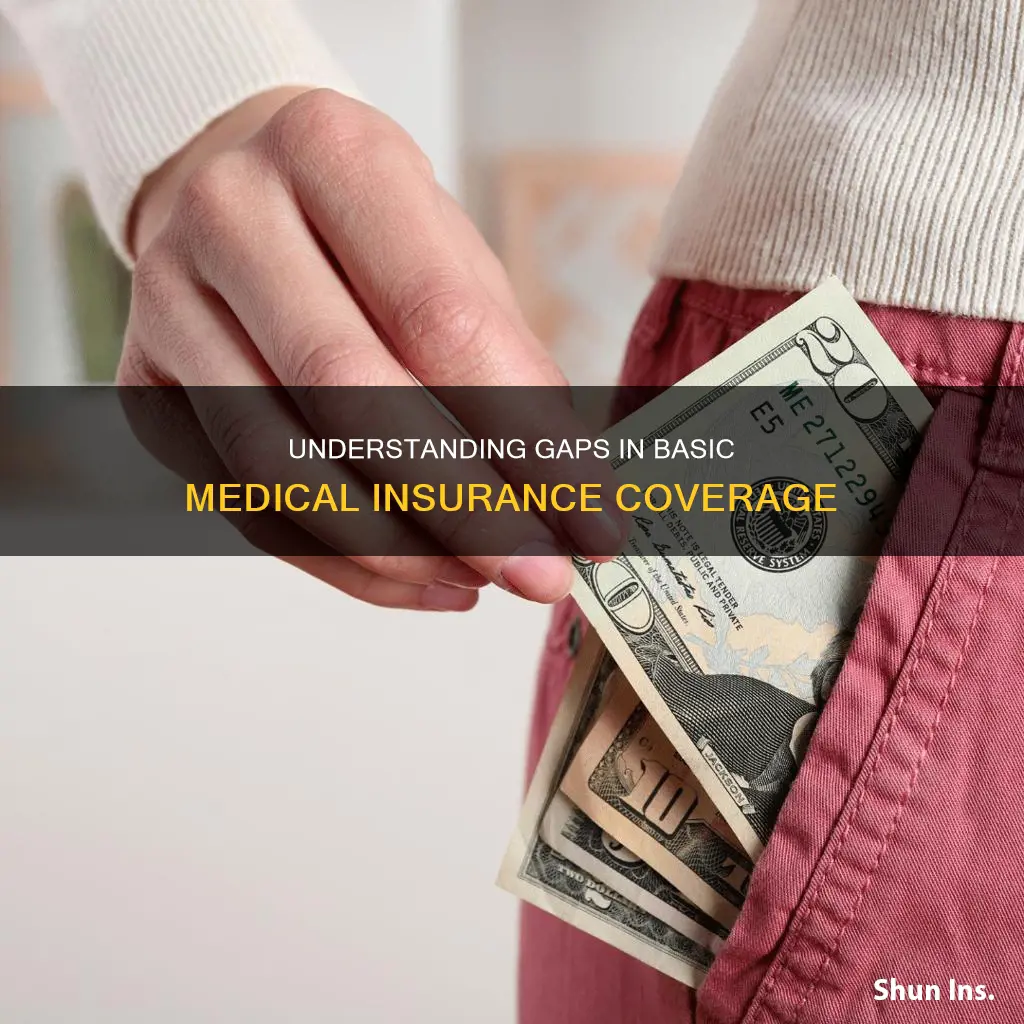 which of the following would basic medical insurance not cover