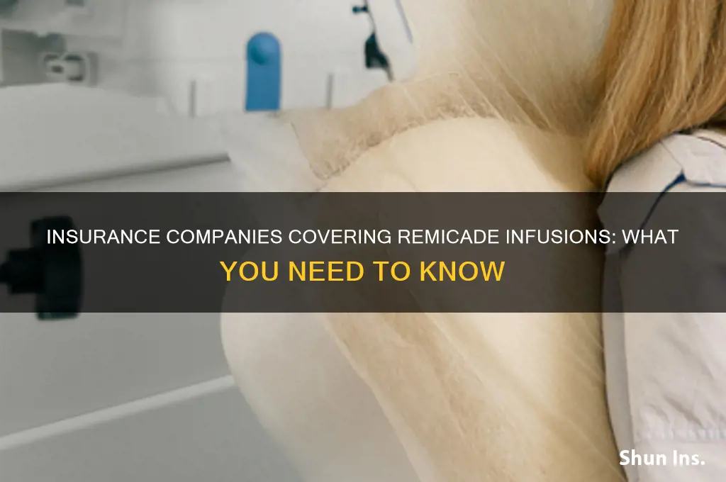 who companies of insurance give remicade infusion