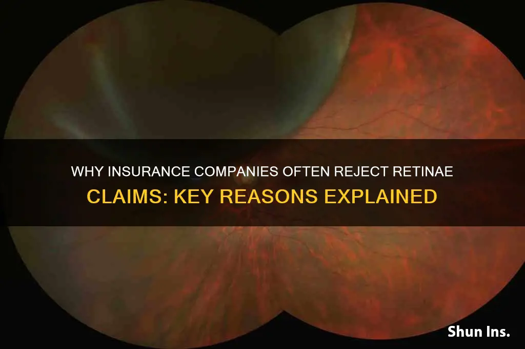 why did the insurance company reject retinae